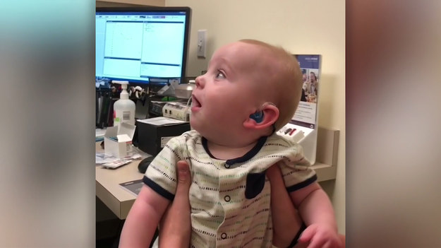 Dziecko urodziło się z wadą słuchu. Dzięki technologi, może od teraz usłyszeć po raz pierwszy głos swoich rodziców. Jak zareaguje?
