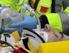 Kubica ponownie operowany. W stawie łokciowym ma szynę