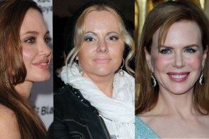 Miss botox