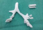 RMF24: Drukarka 3D uratowała życie małemu chłopcu