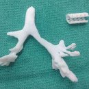 RMF24: Drukarka 3D uratowała życie małemu chłopcu