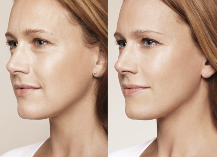 Soft Lifting /materialy promocyjne /materiały promocyjne