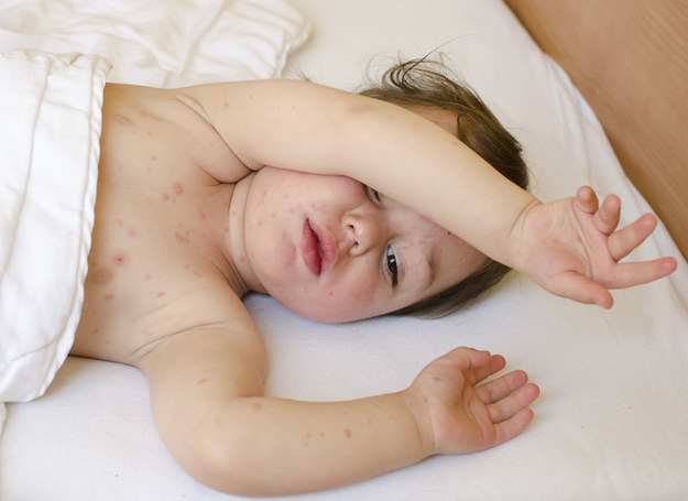 Zadbaj o to, by nie przegrzewać dziecka - to źle działa na skórę. /©123RF/PICSEL