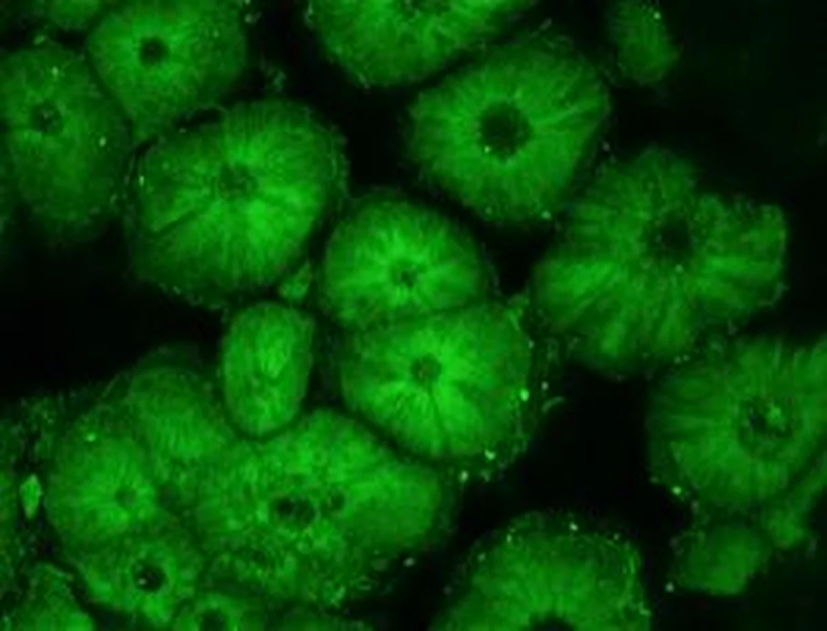 Naukowcy z Uniwersytetu w Perth w Australii, jako pierwsi na świecie wyizolowali DNA ze skorup jaj wymarłych ptaków. Na razie jednak fragmenty DNA, które udało się odzyskać, są za małe, by myśleć o wskrzeszeniu gatunku. Naukowcy podkreślają zresztą, że nie to jest celem ich badań.
