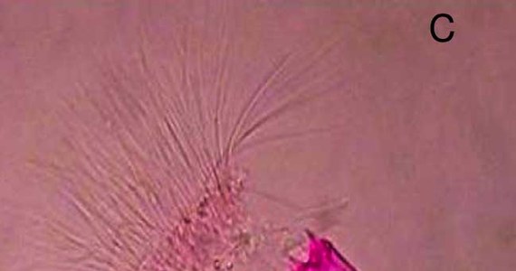 A jednak można żyć bez powietrza. Naukowcy z Polytechnic University of Marche we włoskiej Anconie odkryli pierwszy organizm wielokomórkowy, który może żyć i rozmnażać się bez tlenu. Jak pisze czasopismo "BMC Biology", znaleziono go w głębinach Morza Śródziemnego.