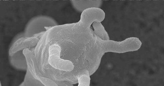 Groźny dla życia grzyb rozprzestrzenia się wśród ludzi i zwierząt na terenie amerykańskich stanów Washington i Oregon oraz kanadyjskiej prowincji Kolumbia Brytyjska. Ostrzegają przed nim na łamach wydawanego przez Public Library of Science czasopisma "PLoS Pathogens" naukowcy z Duke University Medical Center.