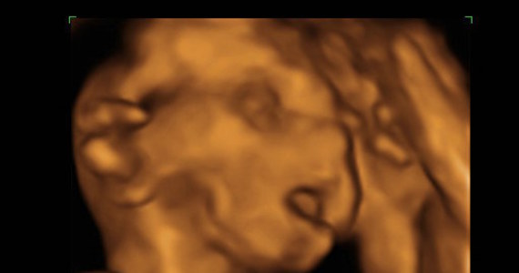 Dziecko w łonie matki nie jest tak bezbronne, jak się do tej pory wydawało. Okazuje się, że układ immunologiczny płodu może zwalczać wirusy na długo przed urodzeniem. Najnowsze wyniki badań naukowców z Brukseli, opublikowane na łamach "Journal of Experimental Medicine", wskazują na to, że dziecko może liczyć na własne komórki odpornościowe już w w 21. tygodniu ciąży.
