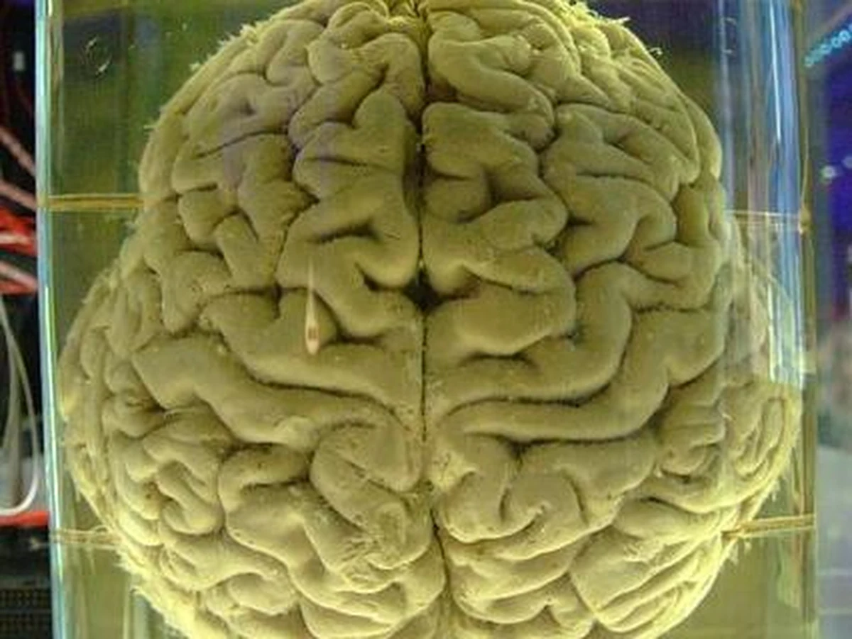 Proste badanie krwi może pomóc w wykryciu zagrożenia chorobą Alzheimera na wiele lat przed pojawieniem się pierwszych objawów. Naukowcy z Instytutu Psychiatrii King's College London odkryli, że o zwiększonym ryzyku świadczy podwyższony poziom białka, klusteryny. Piszą o tym w najnowszym numerze czasopisma "Archives of General Psychiatry".