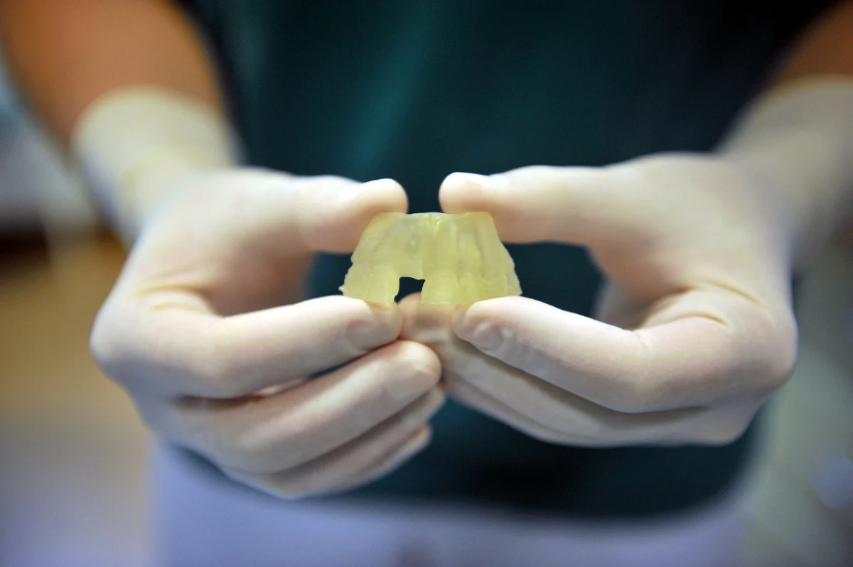 Nowatorski zabieg przeszczepu kości szczęki wykonali lekarze z Poradni Chirurgii Stomatologicznej i Implantologii szpitala im. Wojskowej Akademii Medycznej w Łodzi. Nowość zabiegu polega na tym, że najpierw lekarze stworzyli z żywicy dokładny przestrzenny model szczęki pacjentki, a potem idealnie dopasowali brakującą kość na modelu.