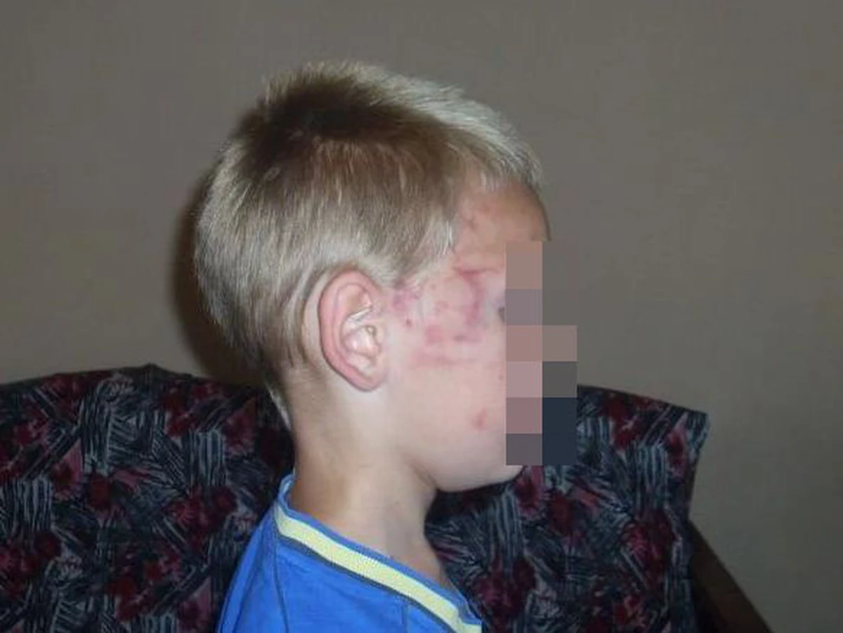 Skandal na koloniach, których organizację zleciło Zachodniopomorskie Kuratorium Oświaty. Rodzice ośmiolatka alarmują, że chłopca przez dwa tygodnie bili koledzy, a opiekunowie niczego nie widzieli. Kuratorium kontroluje ośrodek i odpiera zarzuty.