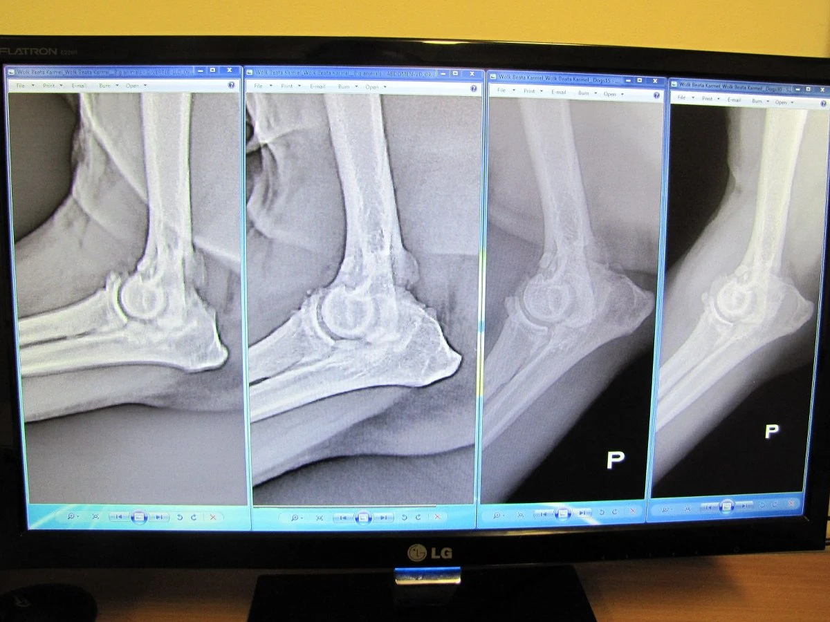 Rewelacyjne wyniki terapii komórkami macierzystymi osiągnęło Lubelskie Centrum Małych Zwierząt. Dzięki niej dwa psy cierpiące na dysplazję odzyskały całkowitą sprawność. Z najnowszych zdjęć RTG wynika, że schorzenie u czworonogów ustąpiło. 