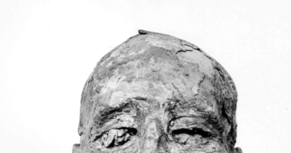 Kryminalna zagadka sprzed blisko 3200 lat została w końcu rozwiązana. Naukowcy z Instytutu ds. Mumii Europejskiej Akademii w Bolzano ogłosili na łamach czasopisma "British Medical Journal", że faraon Ramzes III zginął po tym, jak poderżnięto mu gardło. Takie wnioski to wynik najnowszych badań mumii faraona, w tym analizy obrazu otrzymanego przy pomocy tomografii komputerowej.