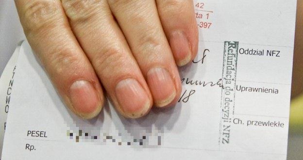 PZ: Lekarze mogą wystawić zaświadczenie o chorobie przewlekłej