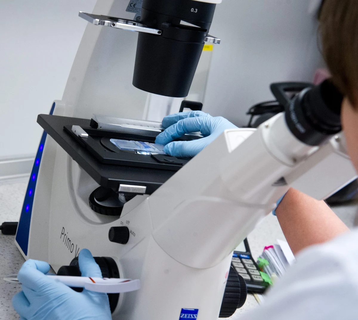 Amerykańscy lekarze ostrzegają przed nową odmianą choroby przenoszonej drogą płciową. Zmutowana odmiana rzeżączki ma być o wiele groźniejsza niż AIDS.