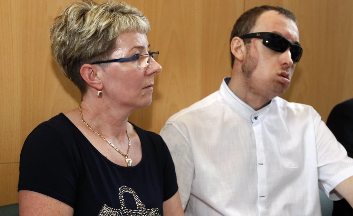 Kaczka upieczona przez mamę - takiego obiadu zażyczył sobie pan Grzegorz, pierwszy w Polsce pacjent, któremu w maju przeszczepiono twarz w Centrum Onkologii w Gliwicach. Dziś opuścił szpital, ale czeka go jeszcze wielomiesięczna rehabilitacja.