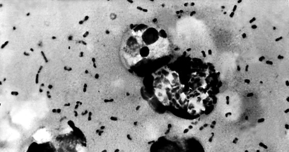 Epidemia dżumy znowu zaczyna zagrażać światu – alarmują naukowcy z renomowanego francuskiego Instytutu Pasteura. Liczba przypadków tej choroby, która w średniowieczu zabiła prawie połowę ludności Europy, znowu zaczyna rosnąć na całym świecie.