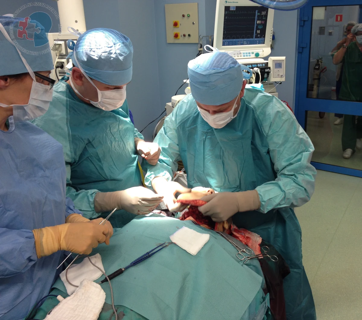 23 godziny trwała operacja całkowitego przeszczepu twarzy u młodej kobiety. Skomplikowanego zabiegu dokonali specjaliści z Centrum Onkologii w Gliwicach. "Pacjentka czuje się dobrze. Jej stan jest ciężki, jak w każdym tego typu przypadku" - podkreślają lekarze. Kobieta miała problemy z jedzeniem, gdyby nie operacja, mogłaby mieć wkrótce problemy z oddychaniem. 