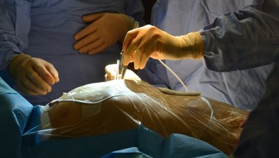 Polscy naukowcy pracują nad nową metodą leczenia blizn po zawale