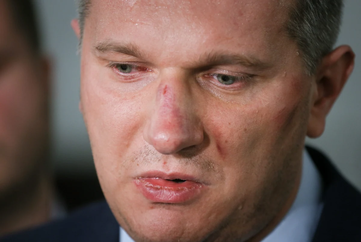 Poseł Przemysław Wipler nie był pod wpływem narkotyków w czasie październikowej bójki z policją przed nocnym klubem w Warszawie. Szef Republikanów miał zaatakować policjantów na ulicy Mazowieckiej. Wbrew zapowiedziom, nadal do Sejmu nie trafił wniosek prokuratury o uchylenie immunitetu posłowi.