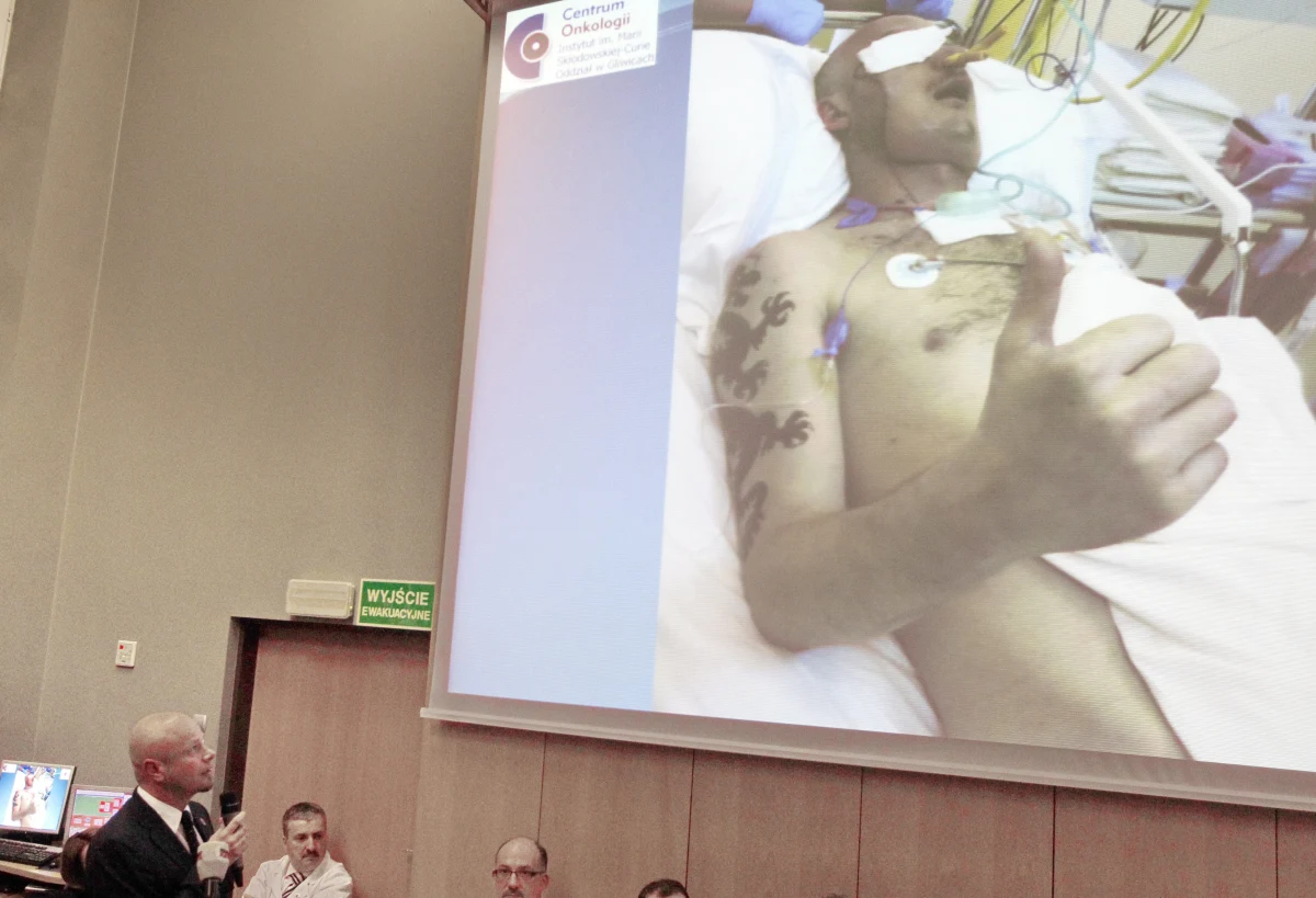 Pierwszy przeprowadzony w Polsce przeszczep twarzy został uznany przez specjalistów za najlepszy na świecie zabieg rekonstrukcyjny ubiegłego roku. Wyróżnienie przyznano na dorocznym zjeździe Amerykańskiego Towarzystwa Chirurgii Rekonstrukcyjnej i Mikronaczyniowej na Hawajach.