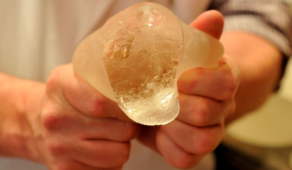 Afera wokół groźnych implantów piersi firmy PIP zatacza coraz szersze kręgi. Francuski sąd zdecydował, że odszkodowania poszkodowanym kobietom będzie musiał wypłacić niemiecki instytut certyfikacyjny, który stwierdził zgodność implantów z obowiązującymi normami. Łatwo pękające protezy wszczepiono blisko 300 tysiącom kobiet na całym świecie, w tym w Polsce.