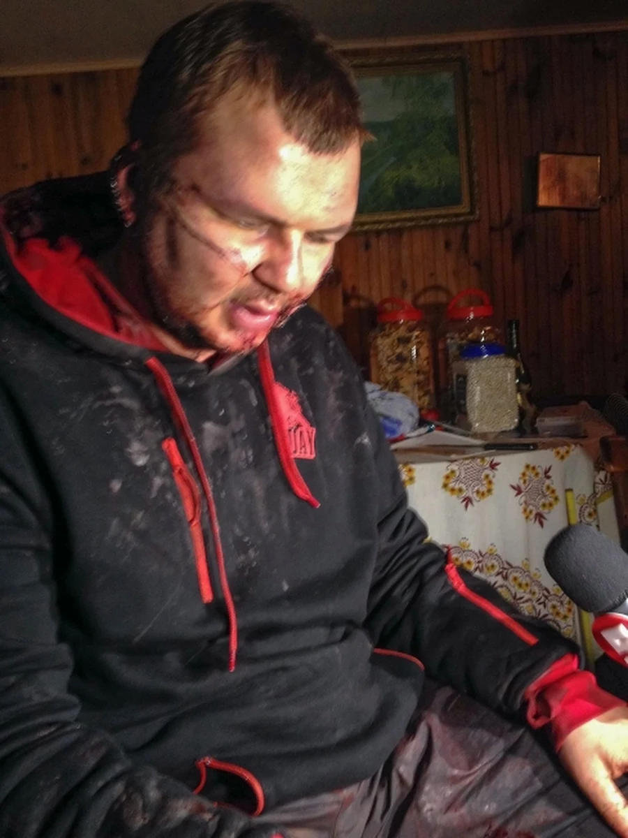 Dmytro Bułatow, lider Automajdanu ciężko pobity przez nieznanych sprawców wyjechał na leczenie zagranicę. Jeden z unijnych dyplomatów poinformował, że aktywista poleciał do Rygi, a stamtąd trafi do Wilna. 