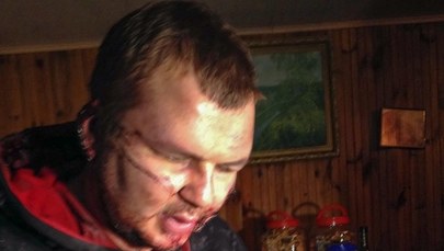 Skatowany lider Automajdanu wyjechał na leczenie