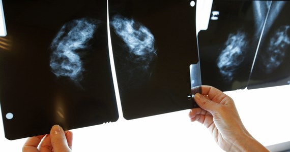Badania mammograficzne nie przynoszą pozytywnych rezultatów w zmniejszeniu liczby zgonów spowodowanych rakiem piersi - twierdzą naukowcy z Kanady. Takie kontrowersyjne wnioski wyciągnęli z trwających 25 lat badań. Opublikowali je w British Medical Journal.