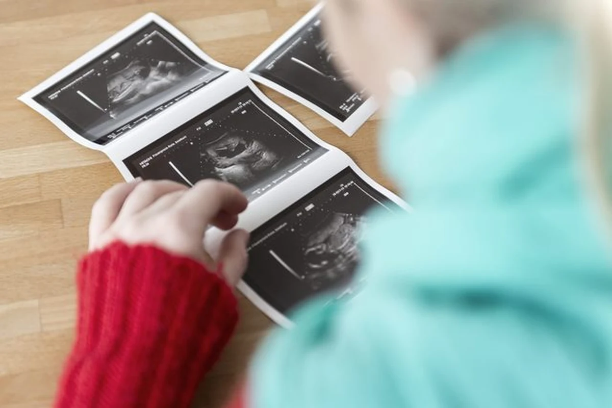 Na Słowacji aborcja z przyczyn innych niż medyczne jest odpłatna, ale jednocześnie państwo refunduje antykoncepcję. W efekcie co roku topnieje liczba pacjentek ze Słowacji i rośnie tych z Polski - pisze "Gazeta Wyborcza".
