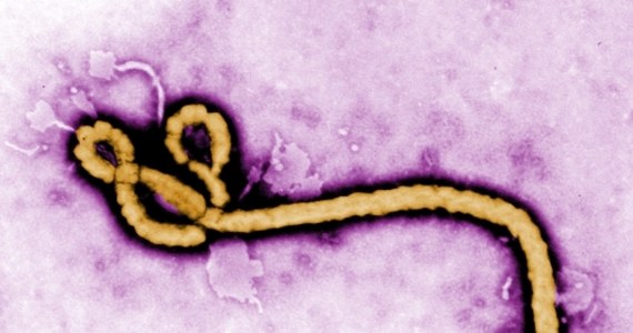 Testy laboratoryjne nie wykazały, że mężczyzna, którego w ciężkim stanie hospitalizowano w Kanadzie, cierpi na gorączkę krwotoczną Ebola - poinformowała Światowa Organizacja Zdrowia (WHO). Na tę chorobę nie istnieje szczepionka ani lek. 