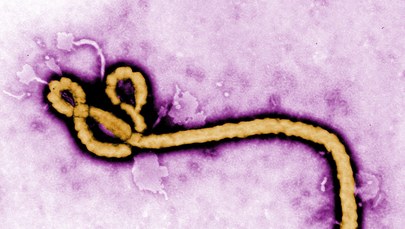 Testy wykluczyły gorączkę krwotoczną Ebola w Kanadzie 