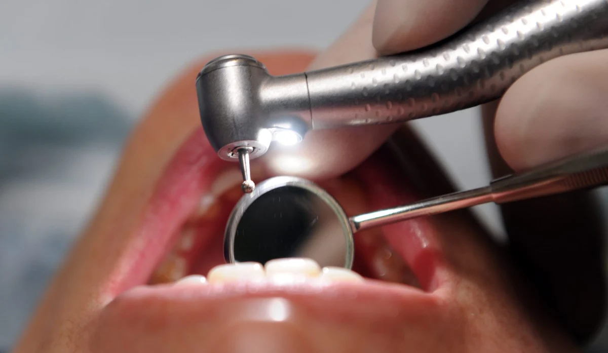 Aż 98 procent Polaków ma różnie nasilone stany zapalne przyzębia, w tym dziąseł - alarmują lekarze. Grozi to nie tylko utratą zębów, ale też zwiększa znacznie ryzyko zawału serca, udaru mózgu, cukrzycy oraz przedwczesnych porodów.