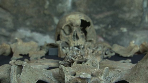 Rok temu w Londynie odkryto cmentarzysko ofiar dżumy - tak zwanej "czarnej śmierci" - która w XIV wieku zdziesiątkowała ludność Europy. Obecnie naukowcy skrupulatnie badają 25 szkieletów mieszkańców średniowiecznego Londynu. Wiadomo już, że wszystkich zabiła dżuma dymieniczna, charakteryzująca się dużym obrzękiem zapalnym węzłów chłonnych pod pachami i w pachwinach.


Współcześnie wydaje nam się, że dżuma to choroba, która już nam nie zagraża. Jest to jednak błędne mniemanie. 15 lat temu dżuma zabiła pewną Amerykankę, która zaraziła się tą chorobą przez kontakt ze śliną kota. Między genomem pałeczki, która wywołała dżumę u kobiety, a genomem pałeczki dżumy sprzed siedmiu wieków istnieje zaskakujące podobieństwo. Dlatego tak ważne jest dogłębne poznanie budowy pałeczki "czarnej śmierci" z XIV wieku i opracowanie skutecznej metody walki z tak agresywną bakterią. Szkielety z Londynu przysłużą się więc nauce i ludzkości. Być może dzięki nim tak straszna epidemia nigdy już nie nawiedzi ludzkości...