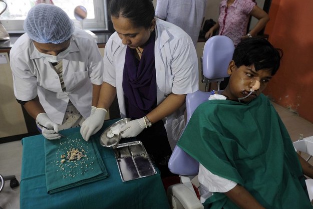 To pierwszy taki przypadek na świecie. W Bombaju w Indiach 17-letniemu Ashikowi Gavaiowi usunięto… 232 zęby. Operacja trwała 7 godzin. Chłopak cierpiał z powodu odontomy (zębiaka) – rzadkiego nowotworu, który powstaje z formujących się w niekontrolowany sposób zawiązków zębów.

 
Gavai trafił w ręce chirurgów z opuchlizną prawej strony dolnej szczęki. Okazało się, że głęboko w kości znajdował się guz z „małymi, przypominającymi perły zębami”. Lekarze znaleźli w jamie ustnej nastolatka także „dziwną strukturę z tkanki przypominającej marmur”, którą usuwali we fragmentach, za pomocą specjalnego dłuta.


Do tej pory „rekordowym” przypadkiem odontomy był przypadek mężczyzny, któremu usunięto 37 dodatkowych zębów z górnej szczęki.