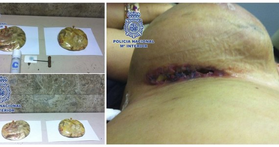 Na lotnisku w Madrycie zatrzymano kobietę, która przyleciała z Bogoty w Kolumbii. Wenezuelka od razu trafiła na stół operacyjny. W implantach piersi przemycała bowiem 1,7 kg kokainy.