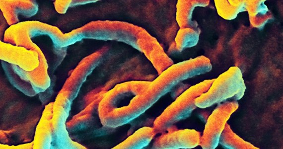 Międzynarodowa organizacja "Lekarze Bez Granic" domaga się zwołania nadzwyczajnego posiedzenia Rady Bezpieczeństwa ONZ. Jego tematem ma być zaostrzająca się epidemia gorączki krwotocznej Ebola. 