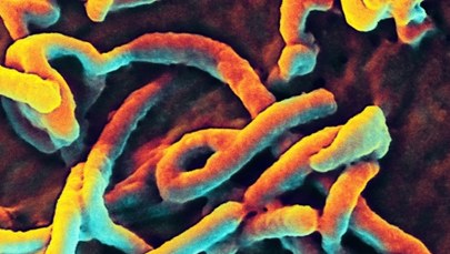 Epidemia eboli. "Do Afryki trzeba wysłać wojsko"