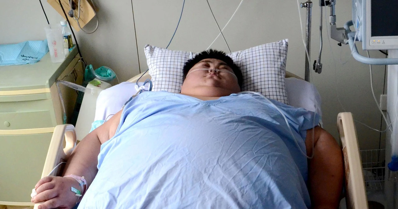 Sun Liang trafił do szpitala z wagą ponad 300 kg 