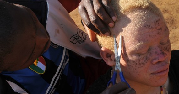 Rząd Tanzanii zabronił praktykowania czarów, by powstrzymać ataki na albinosów. Ich organom przypisywane są magiczne moce. O sprawie  pisze agencja AFP, powołując się na rzecznika tamtejszego MSW.