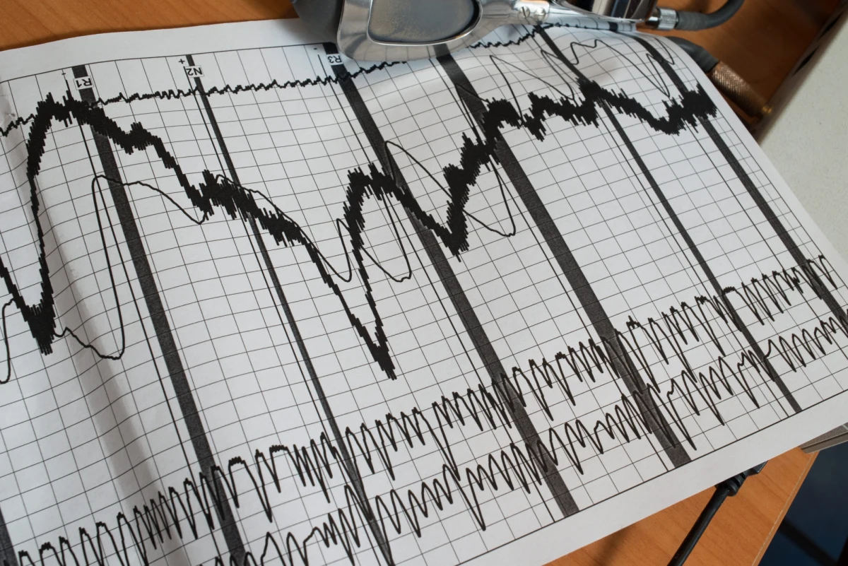 Międzynarodowa Federacja Piłkarzy Zawodowych (FIFPro) stanowczo zaprotestowała przeciwko decyzji władz czeskiego drugoligowego klubu Banik Most o przebadaniu swoich zawodników wykrywaczem kłamstw. Kierownictwo podejrzewa ich o ustawianie meczów. 
