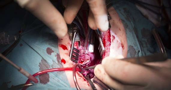 Dramatyczna pomyłka w Uniwersyteckim Szpitalu Klinicznym we Wrocławiu. Lekarz podczas usuwania guza nerki u 57-letniego mężczyzny zamiast chorego narządu usunął zdrowy. Teraz pacjenta czeka druga operacja.