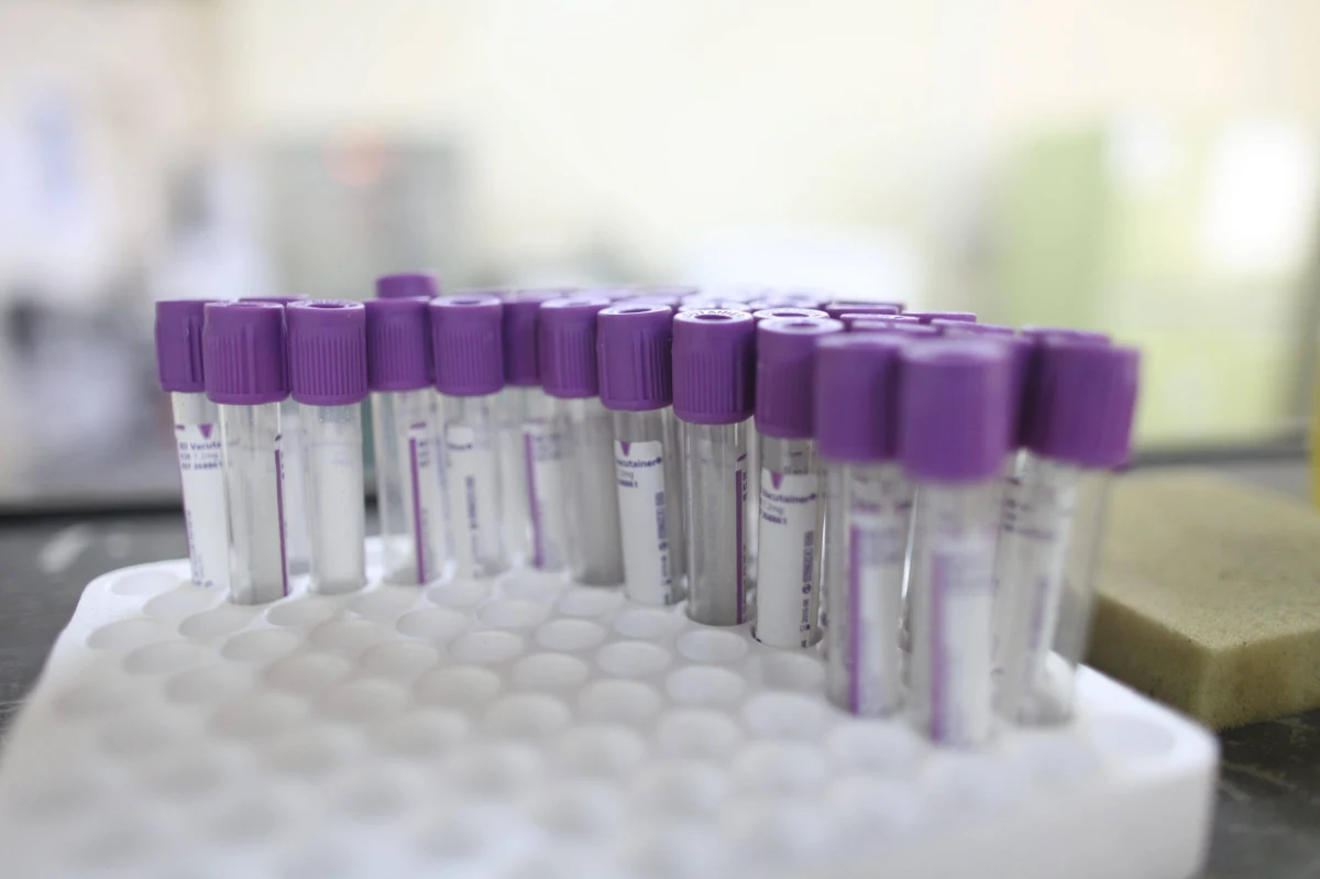 Ok. 30 tys. osób zakażonych HIV na Ukrainie, zaliczanej do krajów najbardziej dotkniętych epidemią i spustoszonej przez toczący się od roku konflikt, może za trzy tygodnie pozostać bez leków. Ostrzega przed tym stowarzyszenie osób zakażonych.