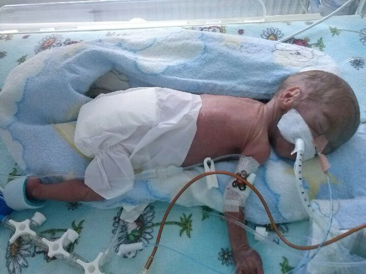 Najmniejszy polski wcześniak opuścił krakowski szpital położniczo-ginekologiczny Ujastek. Rodzice po 5 miesiącach spędzonych z Ksawerym na oddziale neonatologii, teraz będą  mogli nacieszyć synkiem w domu. 