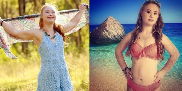 Madeline Stuart, 18-latka z zespołem Downa, od dziecka chciała zostać modelką. Uroda nastolatki zachwyciła fotografów, projektantów i reklamodawców.  Teraz nastolatka zmienia oblicze modelingu. 