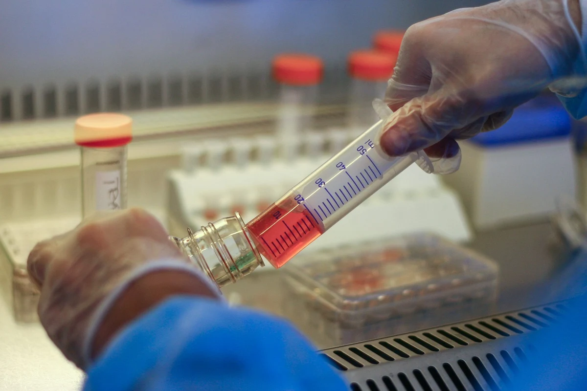 20 dzieci z autyzmem jest leczonych komórkami macierzystymi. Rodzice mówią, że napady agresji są mniejsze. Lekarze z Uniwersyteckiego Szpitala Klinicznego w Lublinie studzą na razie emocje, ale też liczą na efekty: podają dzieciom komórki mezenchymalne. "Na razie mamy duże nadzieje w związku z tą metodą" - mówi w rozmowie z reporterem RMF FM Katarzyna Drabko z Kliniki Onkologii i Hematologii Dziecięcego Szpitala Uniwersyteckiego w Lublinie. 