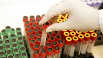 Klinika omyłkowo ujawniła dane pacjentów z HIV 