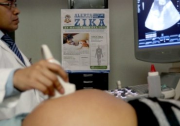 Alarmujące informacje z USA: Wirusem Zika można zarazić się drogą płciową