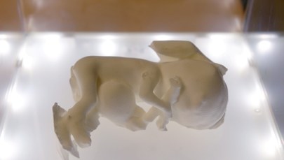 Żywe ludzkie ucho z drukarki 3D