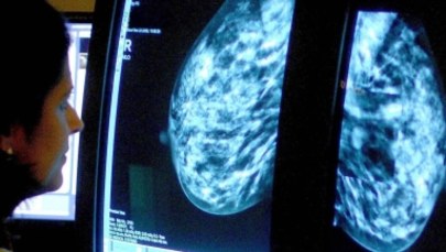 Przełom w walce z nowotworem piersi! Dwa znane leki hamują produkcję komórek rakowych