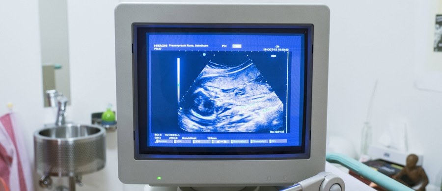 Niepowodzeniem zakończył się pierwszy w Stanach Zjednoczonych przeszczep macicy. Jak donosi agencja Associated Press, narząd, który przeszczepiono 26-letniej kobiecie 25 lutego w Cleveland Clinic w Ohio, trzeba było usunąć. Nie podano przyczyn tego niepowodzenia.